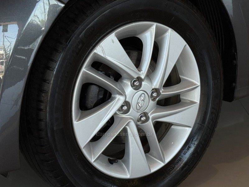 HYUNDAI HB20 1.6 PREMIUM 16V 2012/2013 GRIFFCAR MULTIMARCAS DOIS IRMÃOS / Carros no Vale HYUNDAI HB20 1.6 PREMIUM 16V 2012/2013 GRIFFCAR MULTIMARCAS DOIS IRMÃOS / Carros no Vale