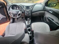 HYUNDAI HB20S 1.6 COMFORT 2016/2016 FERNANDO AUTOMÓVEIS | REVENDA DE CARROS ARROIO DO MEIO ARROIO DO MEIO / Carros no Vale