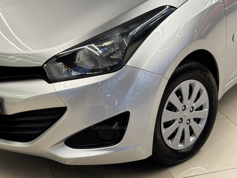HYUNDAI HB20 1.0 COMFORT 12V 2014/2015 GRIFFCAR MULTIMARCAS DOIS IRMÃOS / Carros no Vale HYUNDAI HB20 1.0 COMFORT 12V 2014/2015 GRIFFCAR MULTIMARCAS DOIS IRMÃOS / Carros no Vale