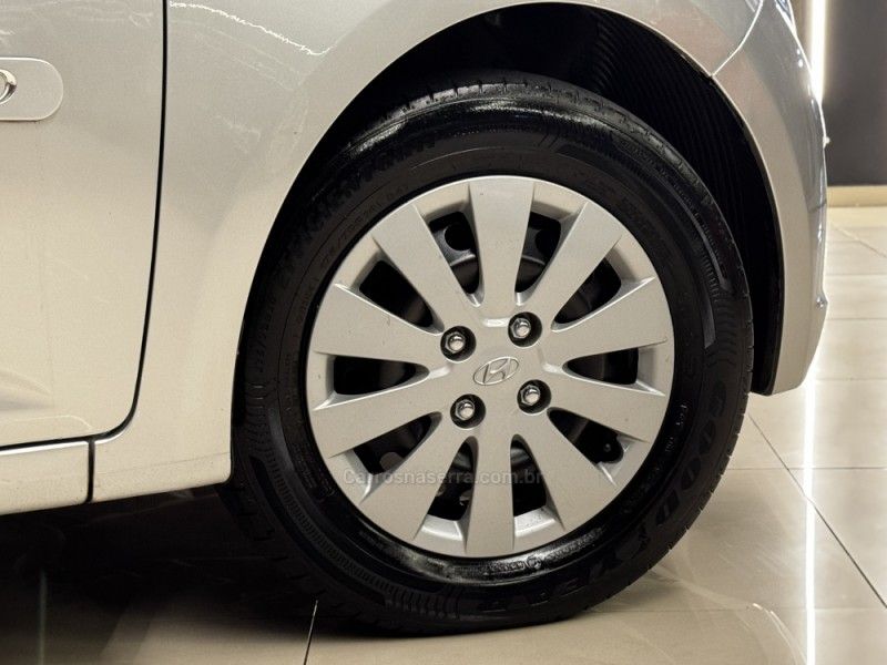 HYUNDAI HB20 1.0 COMFORT 12V 2014/2015 GRIFFCAR MULTIMARCAS DOIS IRMÃOS / Carros no Vale HYUNDAI HB20 1.0 COMFORT 12V 2014/2015 GRIFFCAR MULTIMARCAS DOIS IRMÃOS / Carros no Vale